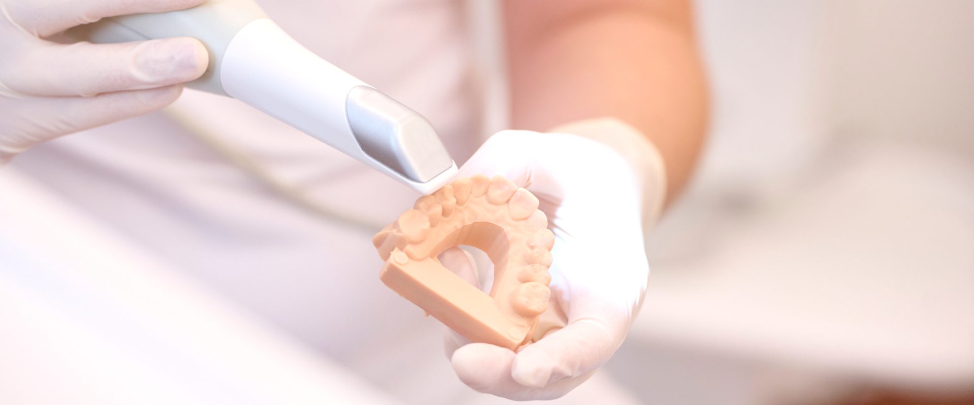 Intraoralscanner